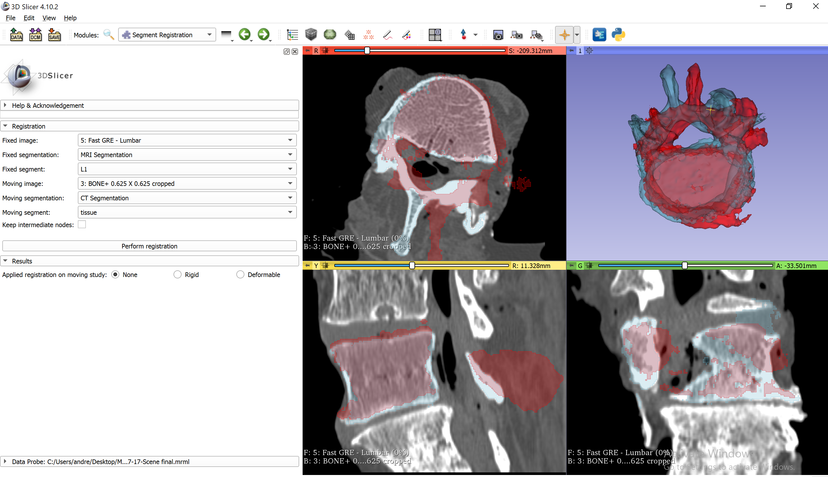 Segmentation on CT and MRI - before registration